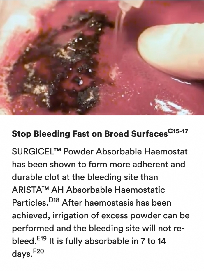 Ethicon SURGICEL® Powder CE 3g Absorbable Hemostatic Powder – Oxidised Regenerated Cellulose – 3023SP (Box of 5)