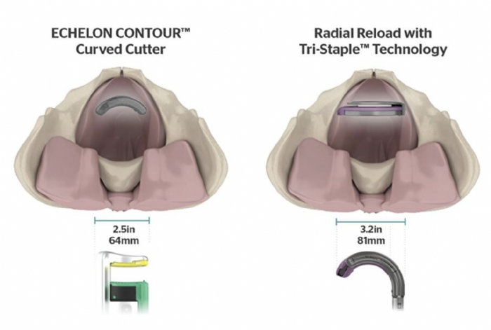 ECHELON CONTOUR™ Curved Cutter GCS40B 40mm Stapler with Blue Reload – Regular Tissue