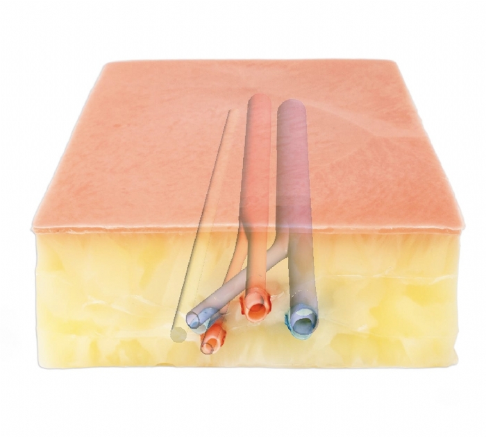 Embedded Femoral Groin Model | Femoral Endarterectomy Training Simulator