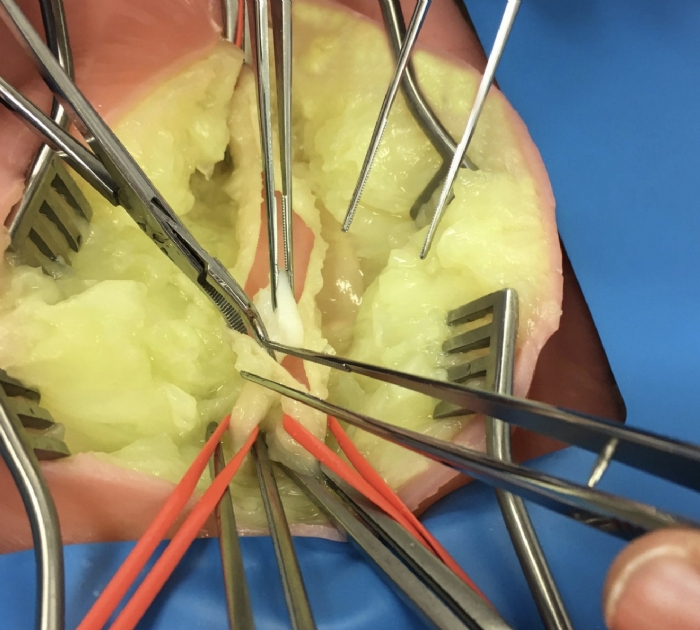 Embedded Femoral Groin Model | Femoral Endarterectomy Training Simulator