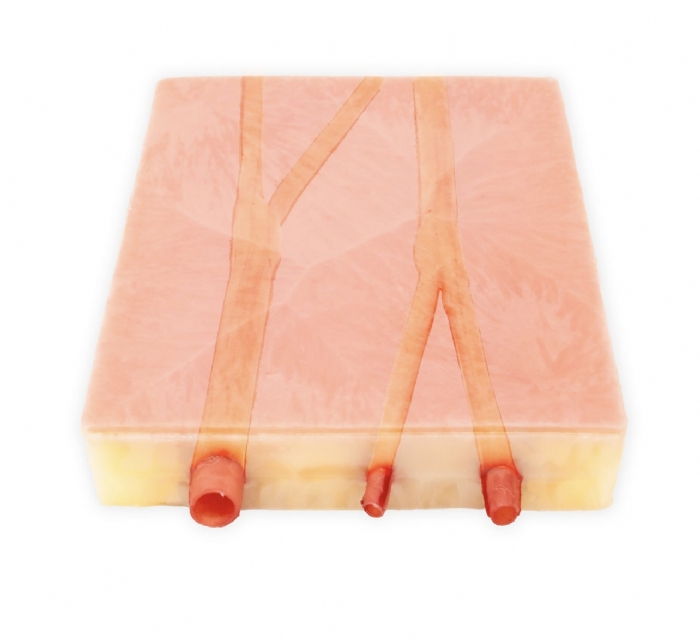 Embedded Carotid Arteries with Plaque and Dermis Model | Carotid Endarterectomy Training Simulator