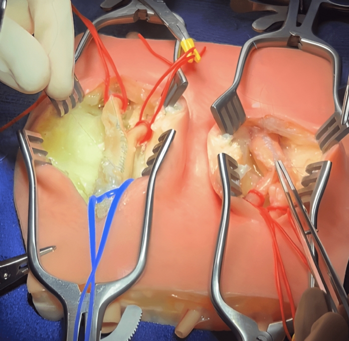 Embedded Carotid Arteries with Plaque and Dermis Model | Carotid Endarterectomy Training Simulator
