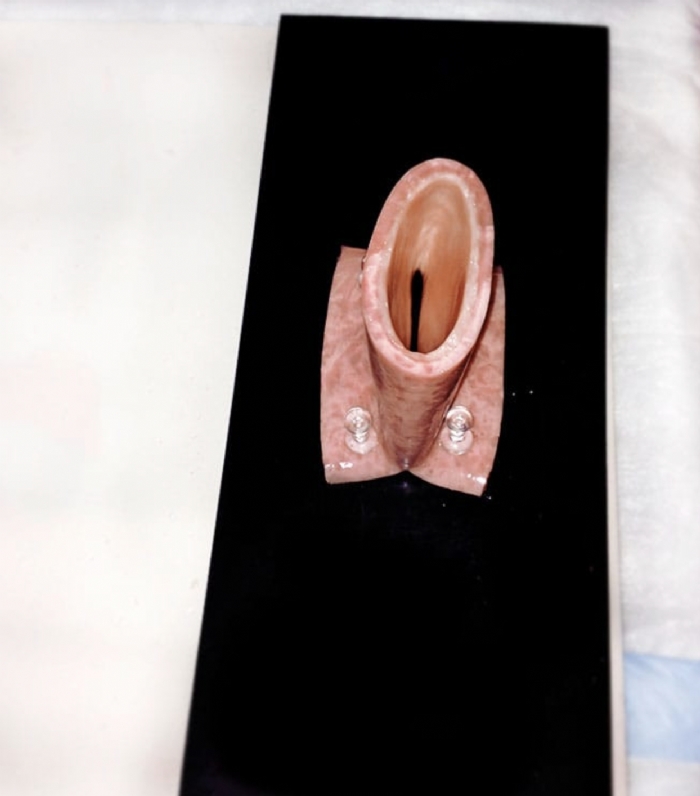 Tissue Mounting Pad | Surgical Training Base for Anastomosis Practice