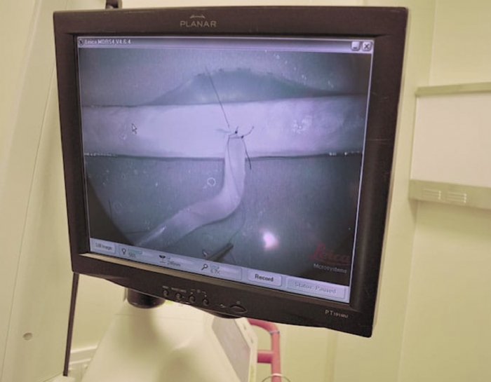 Microvessels Training Models | Microvascular Anastomosis Surgical Simulator