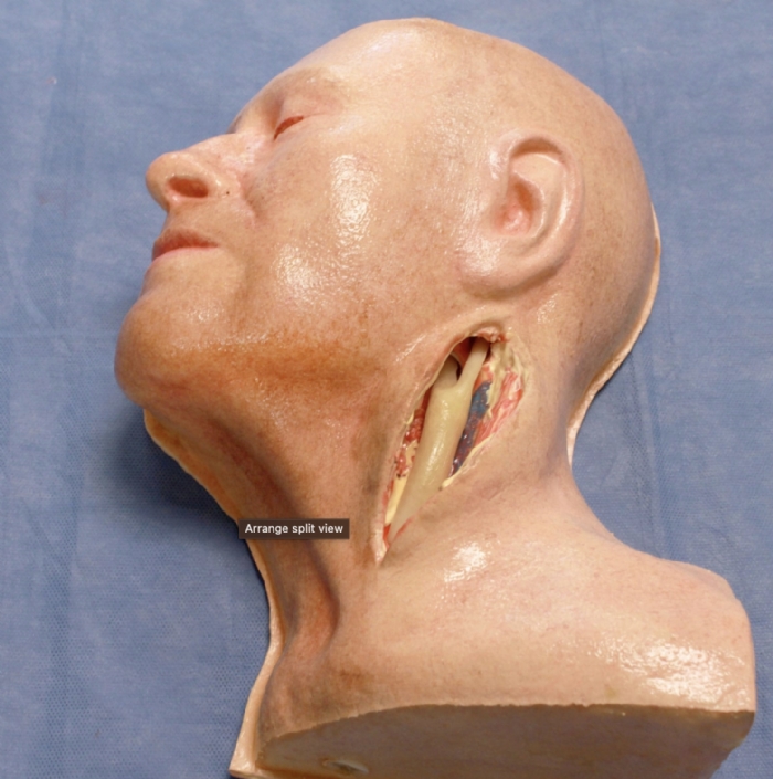 Carotid Artery Training Model | Carotid Endarterectomy Surgical Simulator