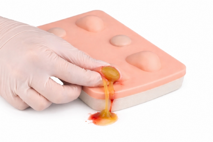 Simulated Skin Suture Pad for Incision & Drainage (I&D) Training – Abscess & Cyst Surgical Skills Practice Model