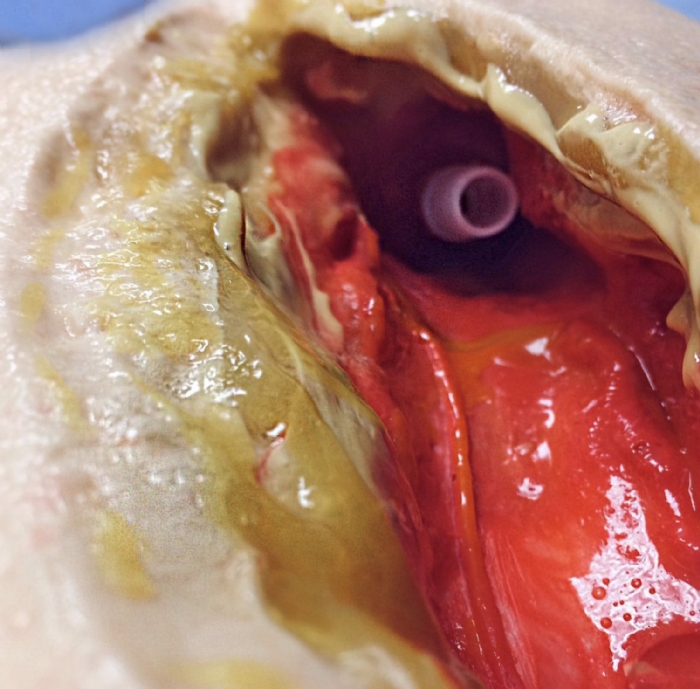 Vascular Surgery Femoral Leg Simulator – Femoral Artery Anastomosis & Bypass Training Model