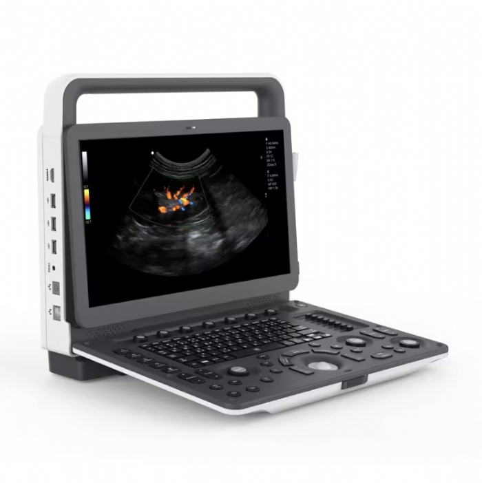 Portable Veterinary Ultrasound Scanner – Digital B-Mode – Convex Probe – Small Animal & Livestock – Model VET-B100 – (UK Stock)