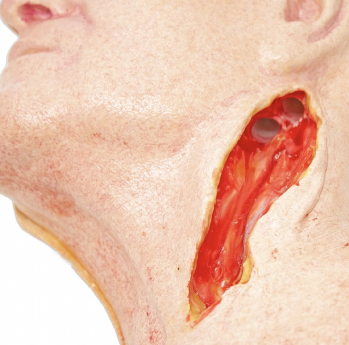 Carotid Head Simulator – Vascular Surgery Training Model – Carotid Endarterectomy Practice – Realistic Surgical Simulation Head – (Professional Training Use)