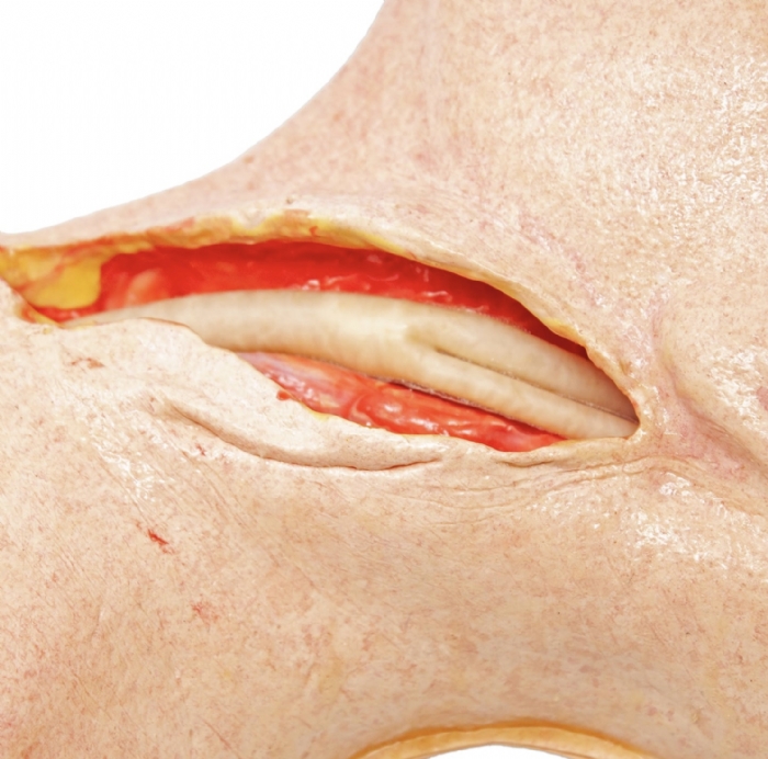 Carotid Head Simulator – Vascular Surgery Training Model – Carotid Endarterectomy Practice – Realistic Surgical Simulation Head – (Professional Training Use)