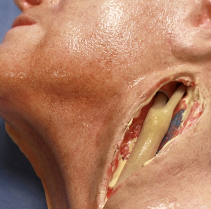 Carotid Head Simulator – Vascular Surgery Training Model – Carotid Endarterectomy Practice – Realistic Surgical Simulation Head – (Professional Training Use)