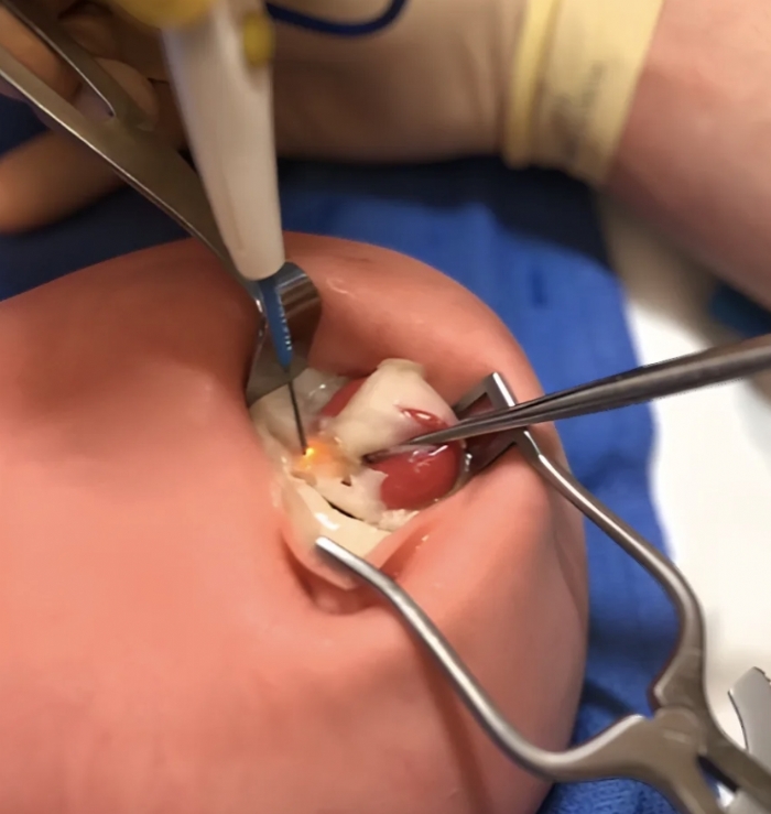 Breast Biopsy Training Model – Ultrasound-Guided Needle Biopsy Simulator – Palpation & Lesion Detection Training – (Professional Medical Training Use)